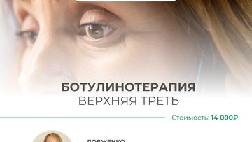 Ботулинотерапия